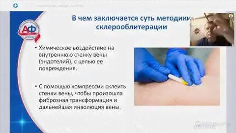 Семенов А. Ю. - Склеротерапия как искусство! 20 летний опыт склеротерапии: тактика, техника, нюансы.