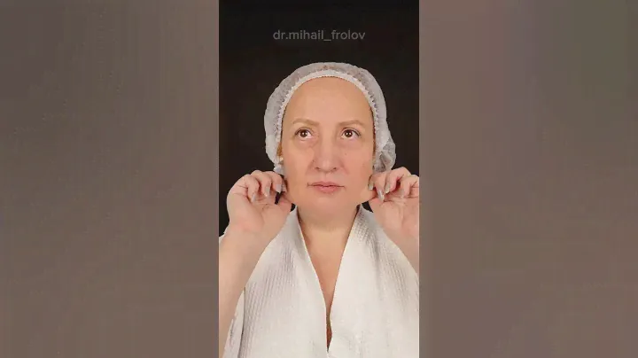 Deep plane фейслифинг. нижняя блефаропластика. Доктор ФРОЛОВ